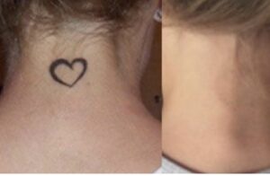 A woman with a heart tattoo on her neck.