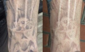 A man with tattoos on his arm before and after.