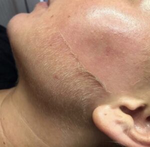 A woman's face with a scar on it.