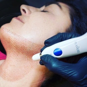 A woman is getting a laser treatment on her face.