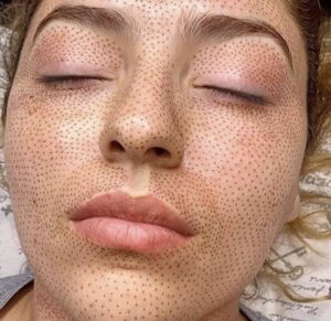 A woman with freckles on her face.