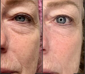 g1 - Elmira Studio Before and after pictures of a woman's eyes.