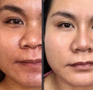 g2 - Elmira Studio Before and after photos of a woman's face.
