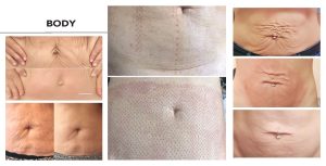A series of photos showing the different stages of a woman's body.