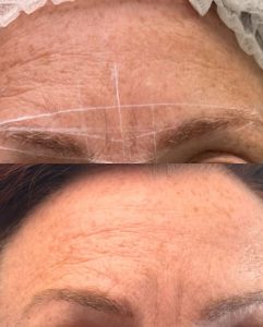 elmirastudio_posts_47 - Elmira Studio A woman's eyebrows before and after treatment.
