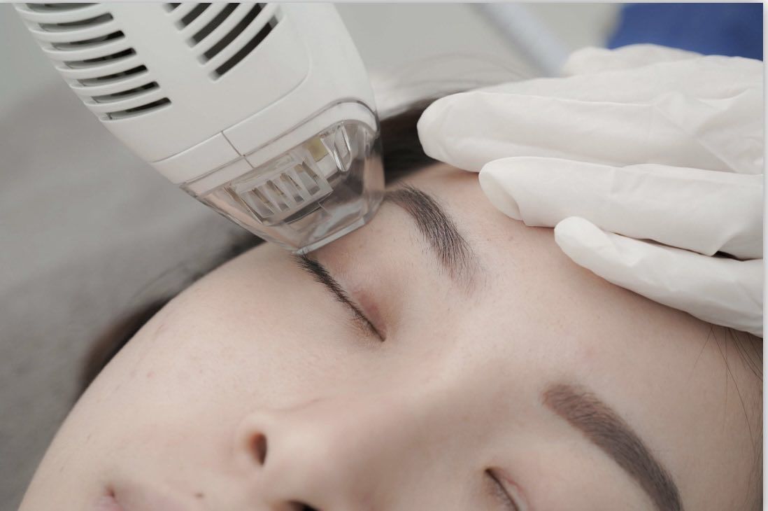 Tixel® Skin Rejuvenation in-Westlake- - Elmira Studio Tixel® Skin Rejuvenation in-Westlake-